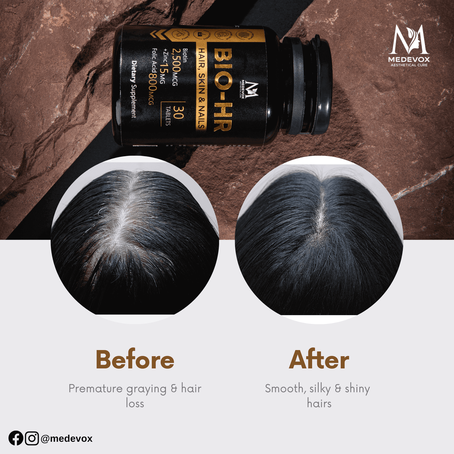 Anti-Hairfall Bundle: Grow ME | Bio HR